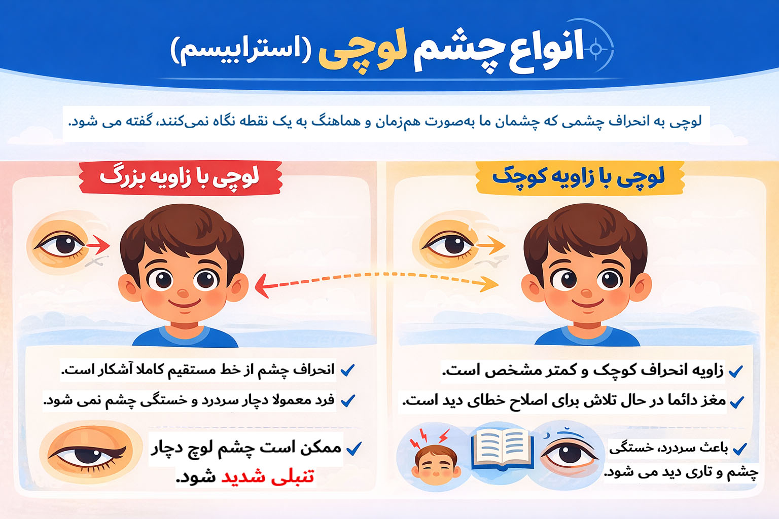 انواع لوچی چشم انواع لوچی چشم