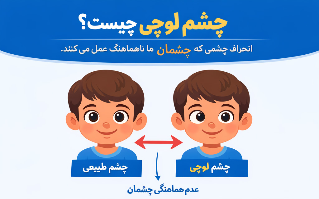 چشم لوچی چیست؟